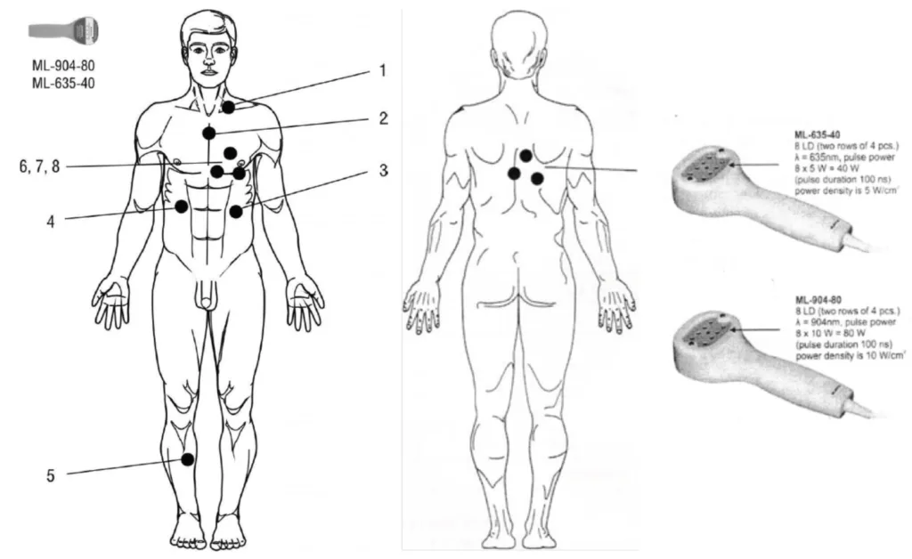 Diagrama de aplicação de dispositivos médicos em corpo humano