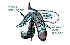 Figura 13