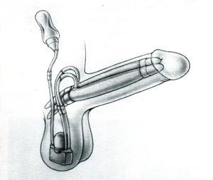 Figura 21