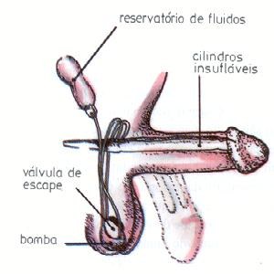Figura 23